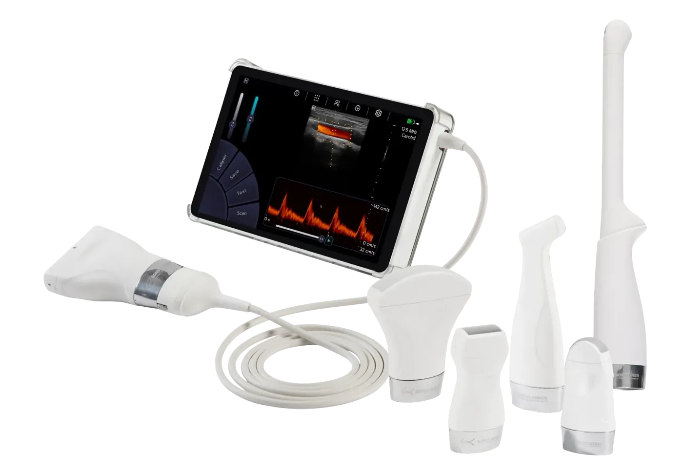 U-Lite Pro — преміальний кишеньковий ультразвуковий апарат Sonoscanner