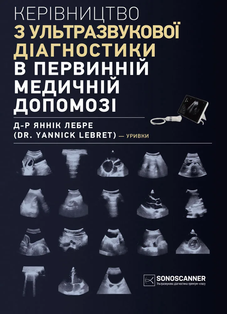 Обкладинка керівництва з ультразвукової діагностики в первинній медичній допомозі