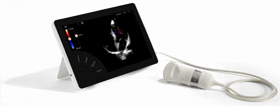 T-Lite Pro — спеціалізована ультрапортативна ультразвукова система Sonoscanner